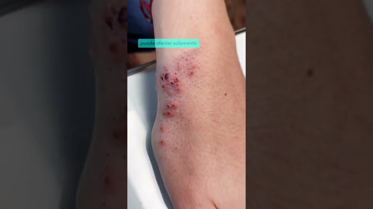 Cómo reconocer y tratar infecciones fúngicas en reptiles