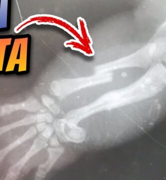 Errores comunes durante la reproducción de reptiles explicada por veterinarios